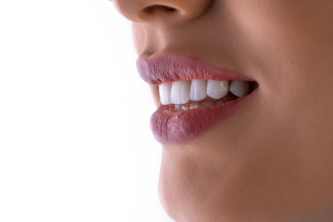 Smile Designing in Indore at Dream Smile Dental Clinic